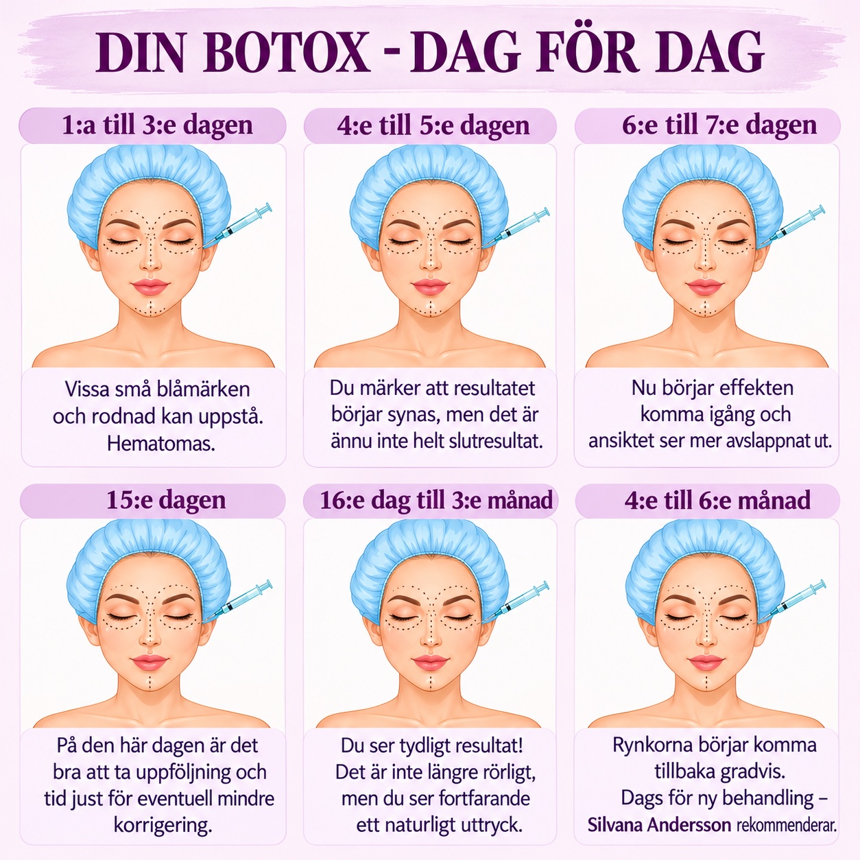 Tidslinje över en rynkbehandling dag för dag: under dag 1–3 kan små blåmärken och rodnad uppstå, dag 4–5 börjar resultatet synas, dag 6–7 kommer effekten igång, dag 15 är det dags för uppföljning, från dag 16 till månad 3 syns resultatet tydligt, och under månad 4–6 återkommer rynkorna gradvis, vilket är dags för ny behandling.